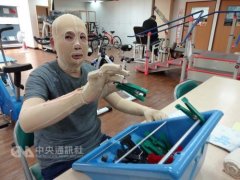 台湾男子严重烧伤忍痛锻炼：早日重返职场养家
